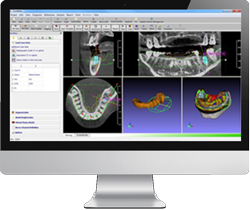 Scan Implant Guide Planning Software